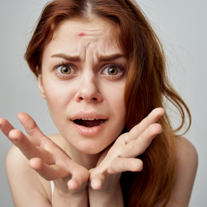 Akne & unreine Haut adé