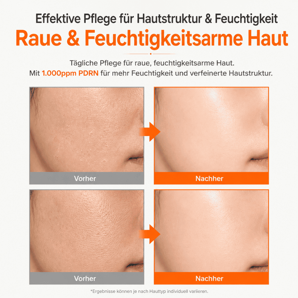Translation missing: de.products.product.gallery_thumbnail_alt
