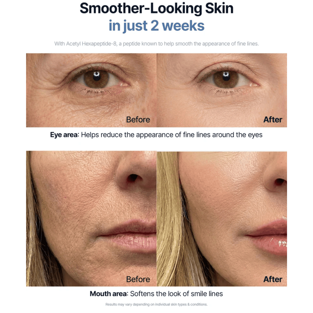 Translation missing: de.products.product.gallery_thumbnail_alt
